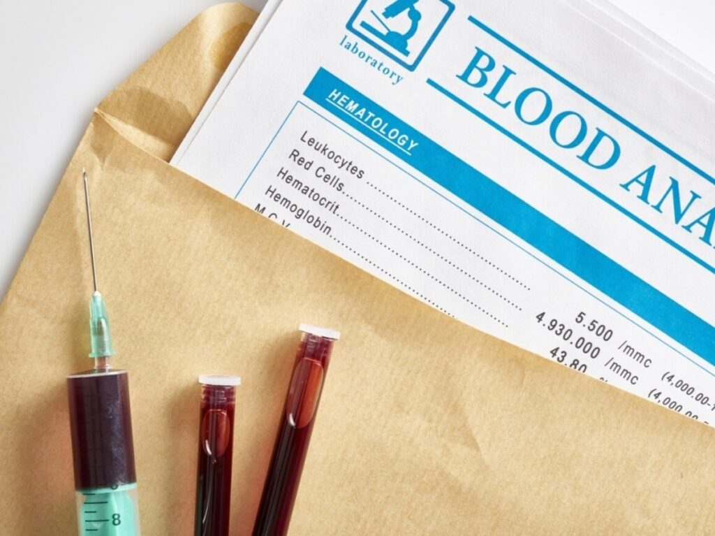 Decode Your Blood Test: Normal Cholesterol Levels to Pulse Rate