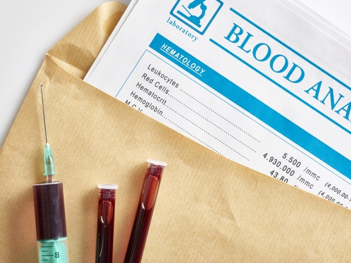 Decode Your Blood Test: Normal Cholesterol Levels to Pulse Rate